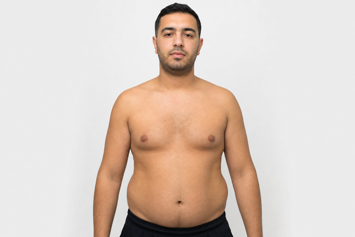 Résultat client — après